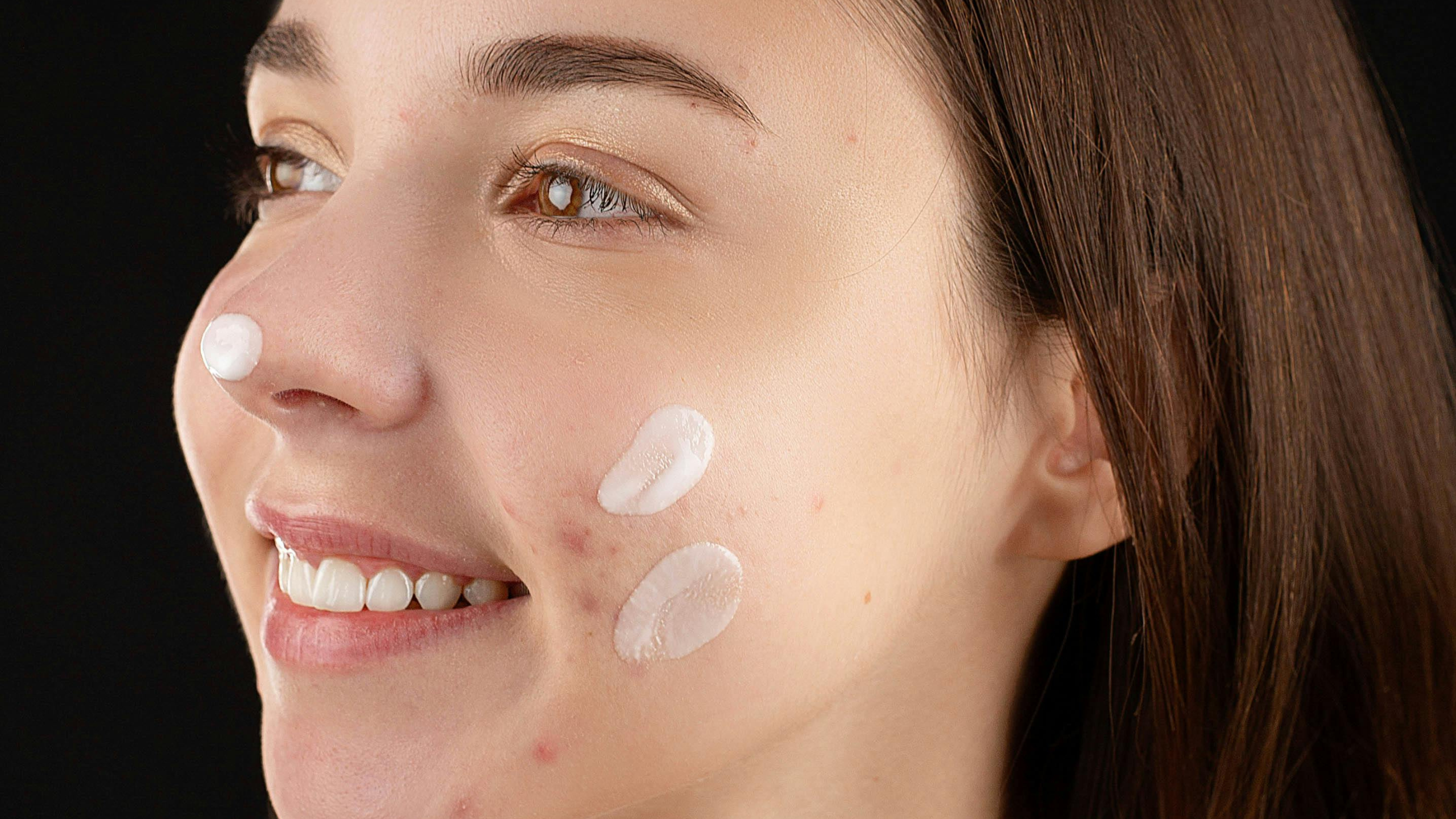 clear skin tips, acne free skin