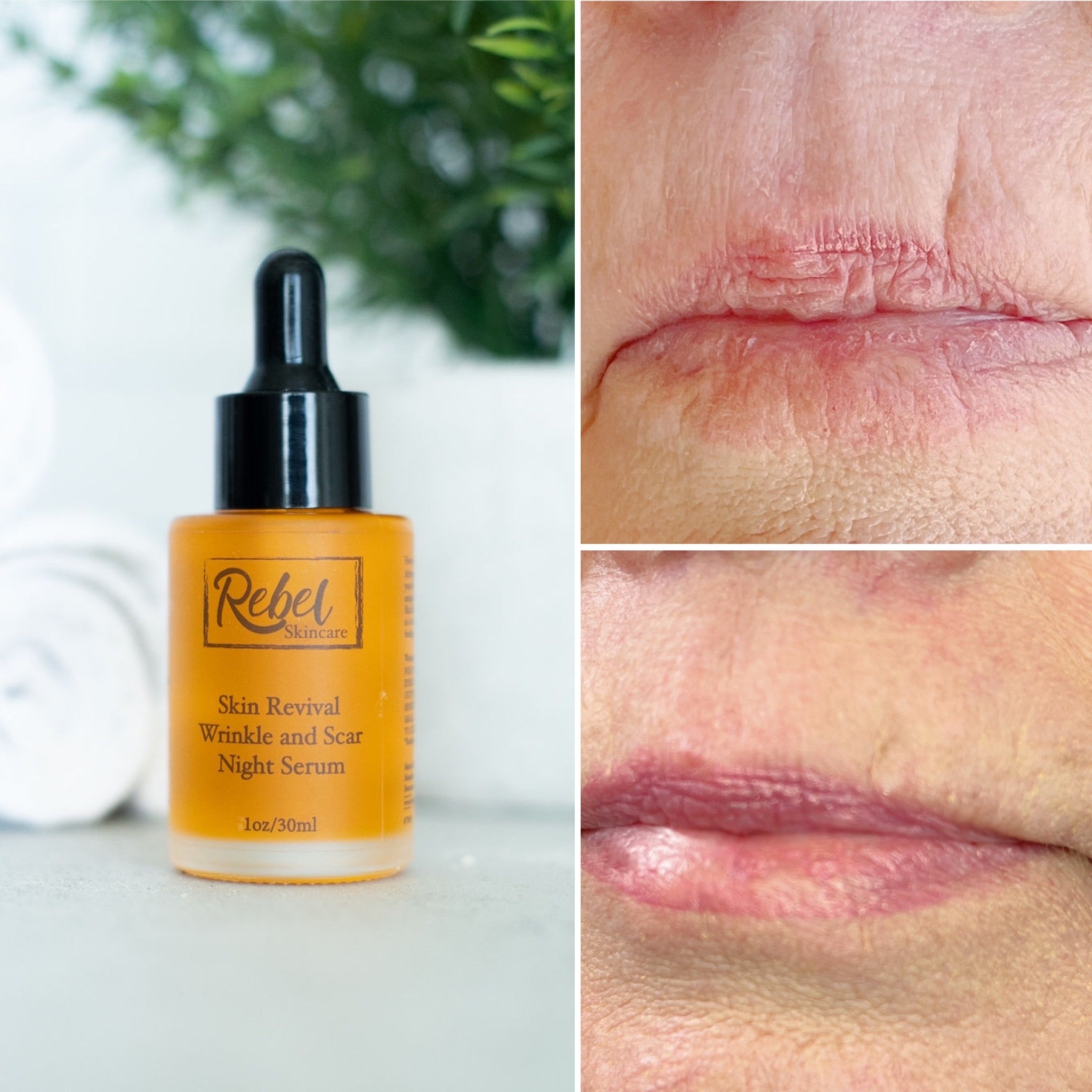 Skin Revival Wrinkle and Scar Night Serum
