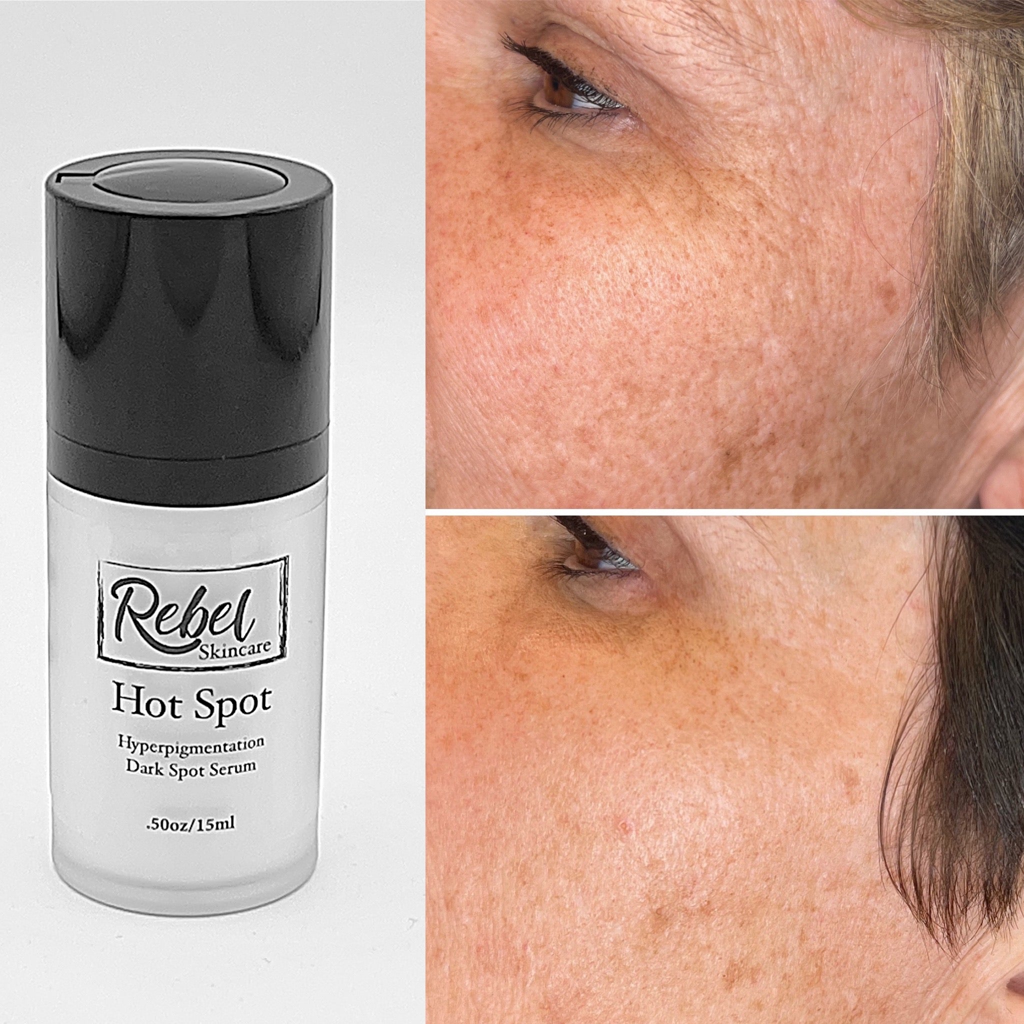 Hyperpigmentation Bundle: Skin Polish, Skin Revival, and Hot Spot